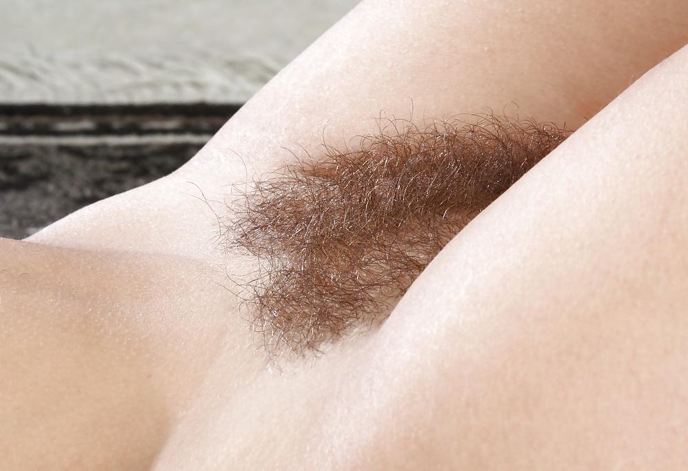 25P From the Moshe Files: Sweet Hirsute