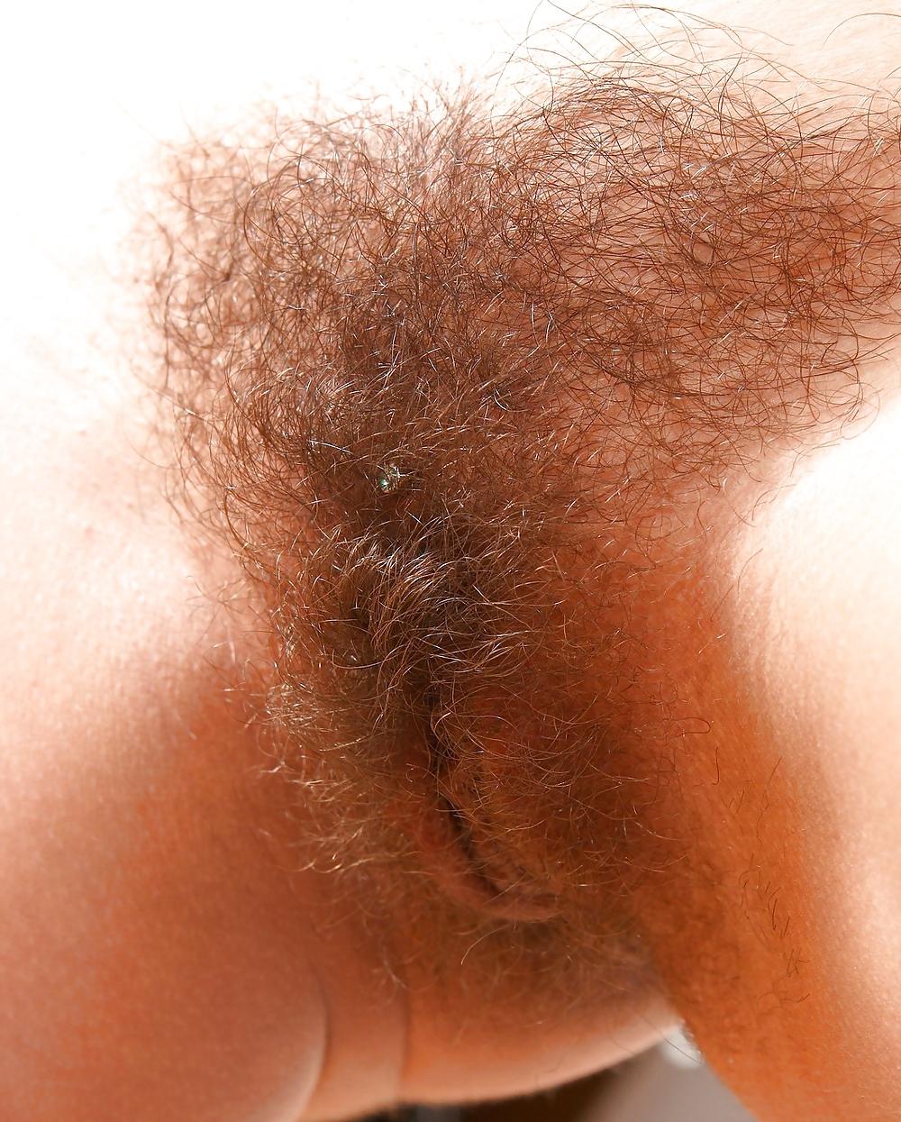 25P From the Moshe Files: Sweet Hirsute