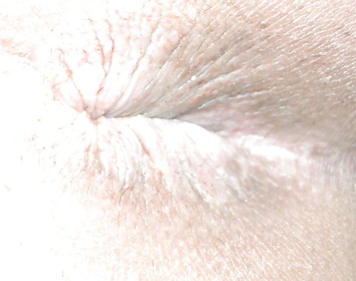11P Teen girlie butthole april 2013