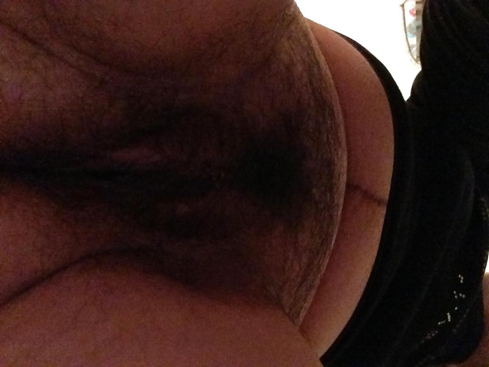 12P Always hairy me