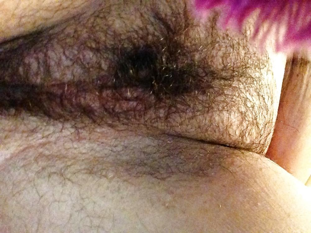 12P Always hairy me