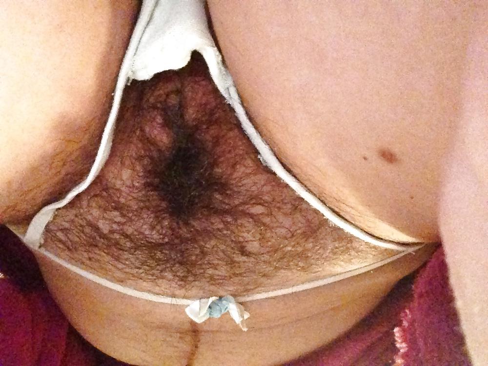 12P Always hairy me