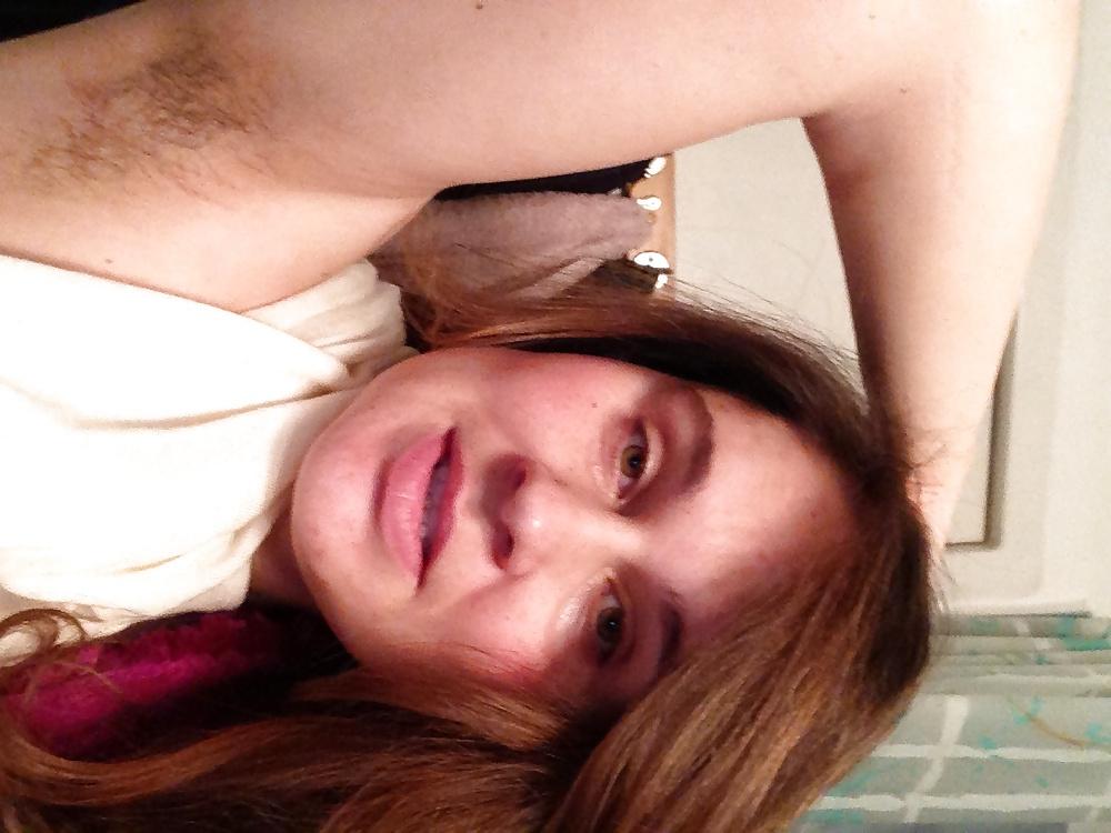 12P Always hairy me