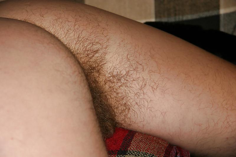 20P My hairy friend