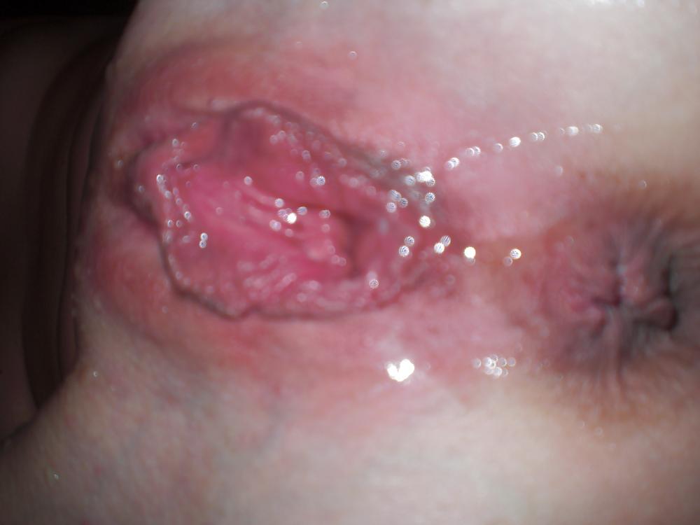 9P Dutch amateur slut