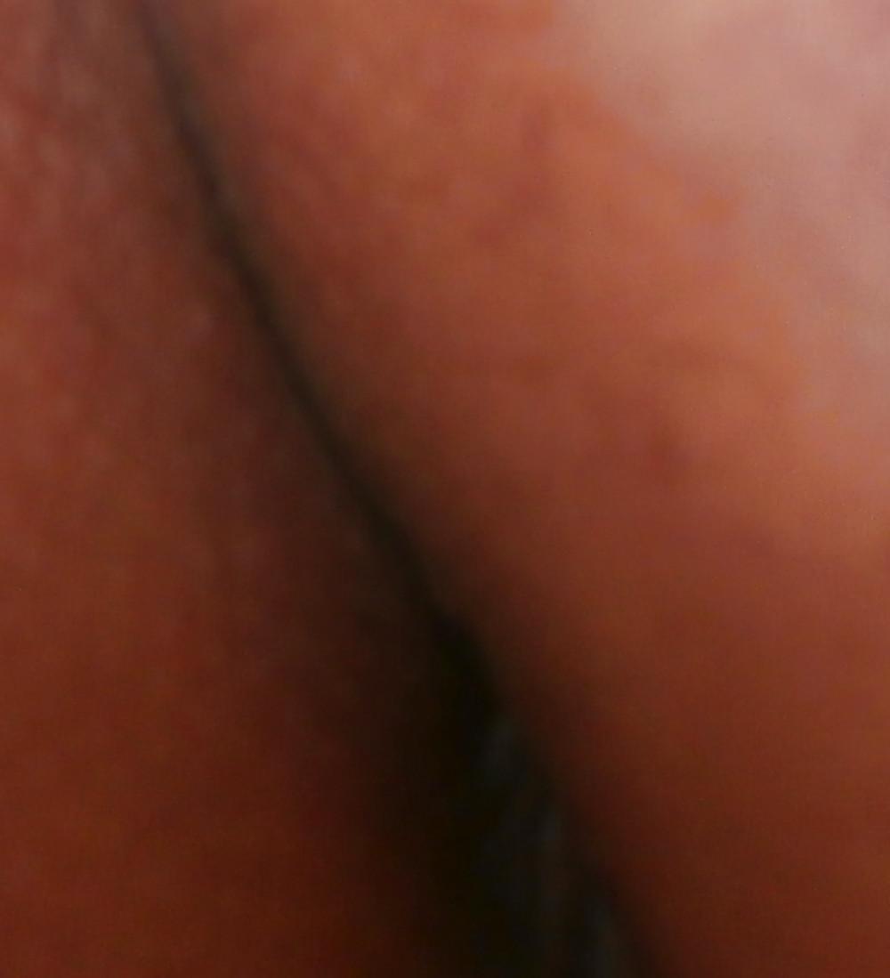 14P New butthole pics