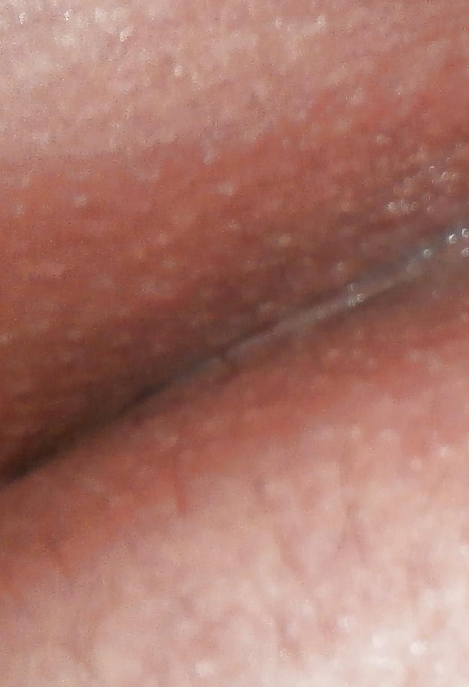 14P New butthole pics