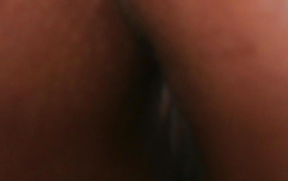 14P New butthole pics