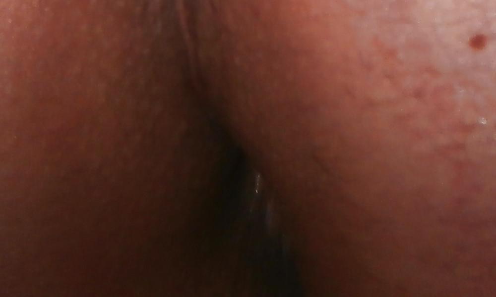14P New butthole pics