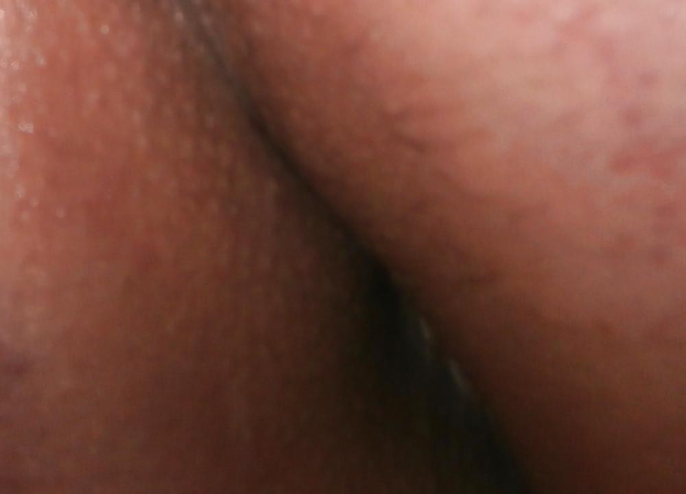 14P New butthole pics
