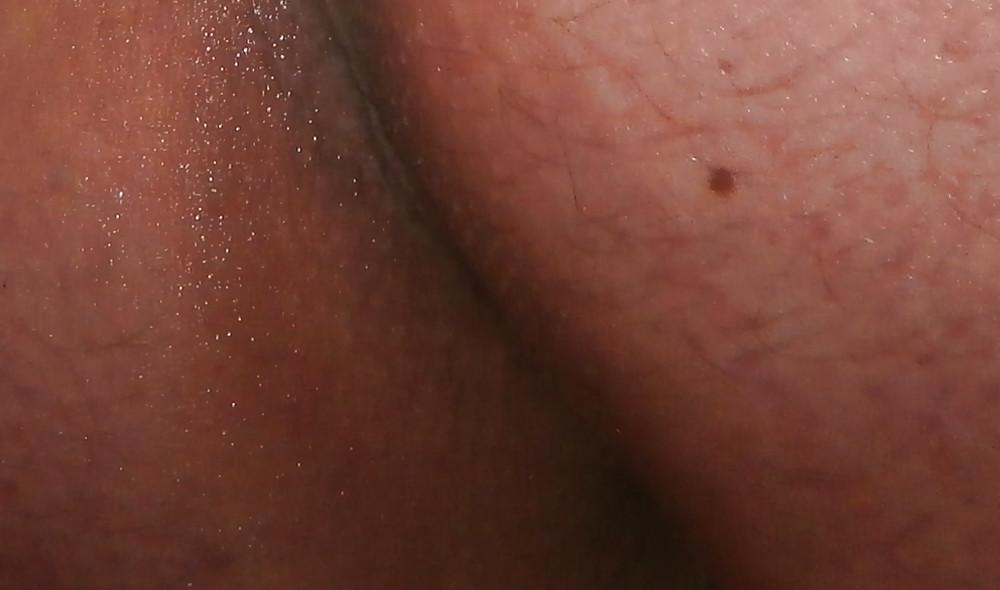 14P New butthole pics
