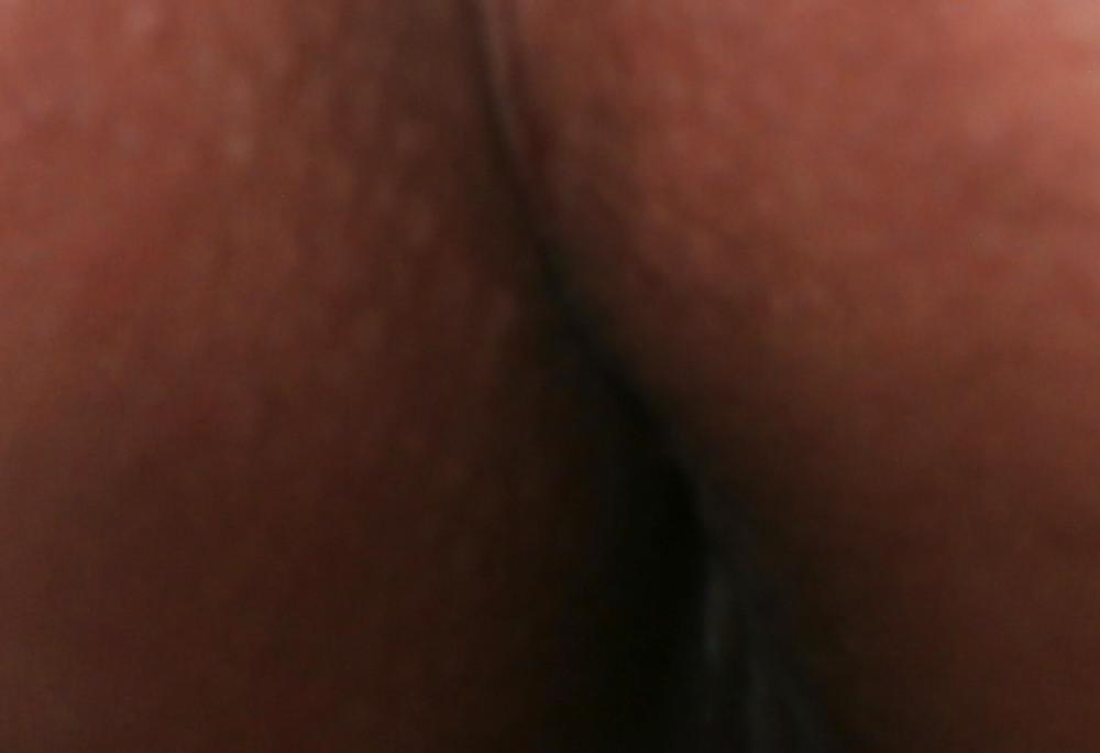 14P New butthole pics