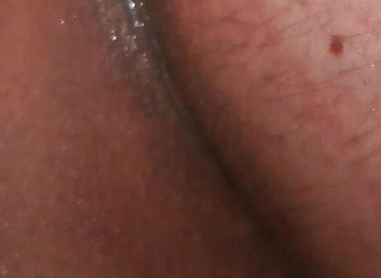 14P New butthole pics