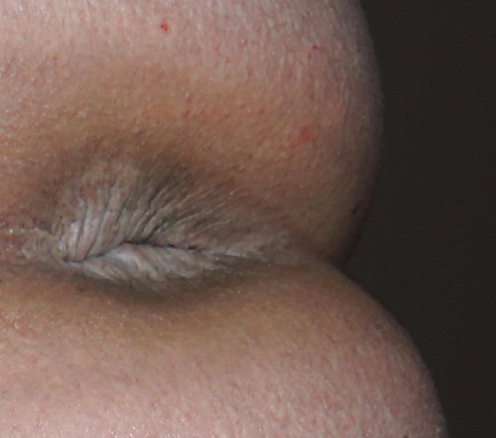 12P Amandas teen butthole