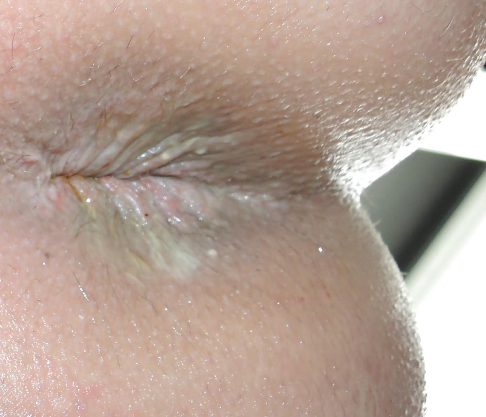 12P Amandas teen butthole