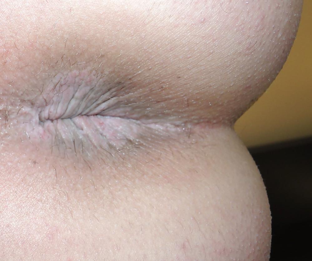 12P Amandas teen butthole