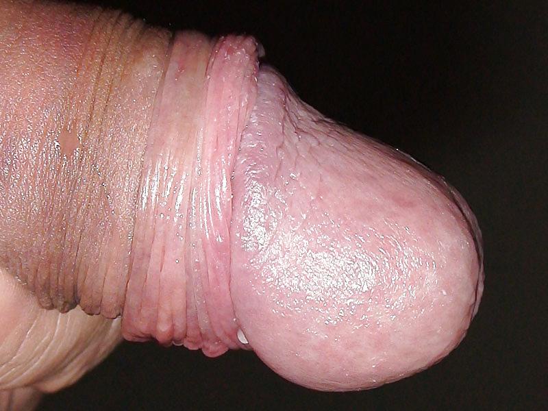 25P Penis-Studien sofr 2008