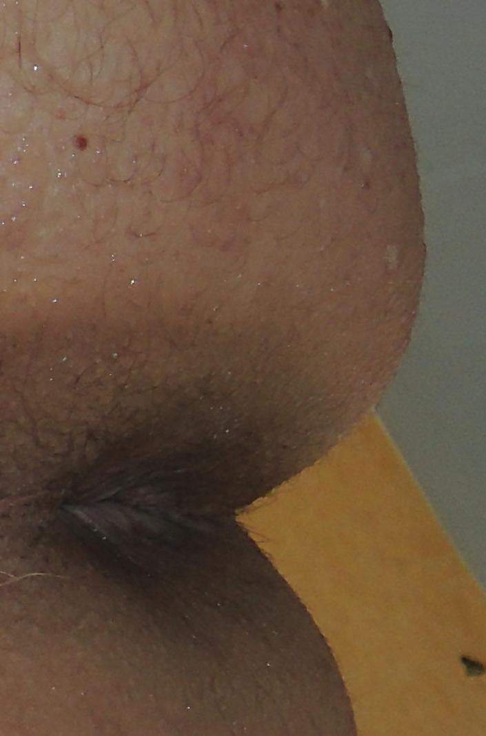 11P Teenage girl Amanda and her virgin butthole