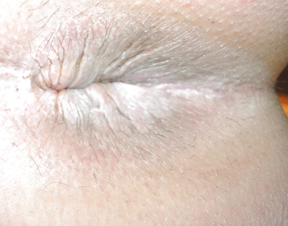 25P Amandas butthole march 2013