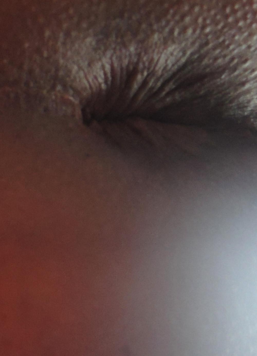 25P Amandas butthole march 2013