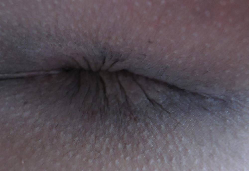 25P Amandas butthole march 2013