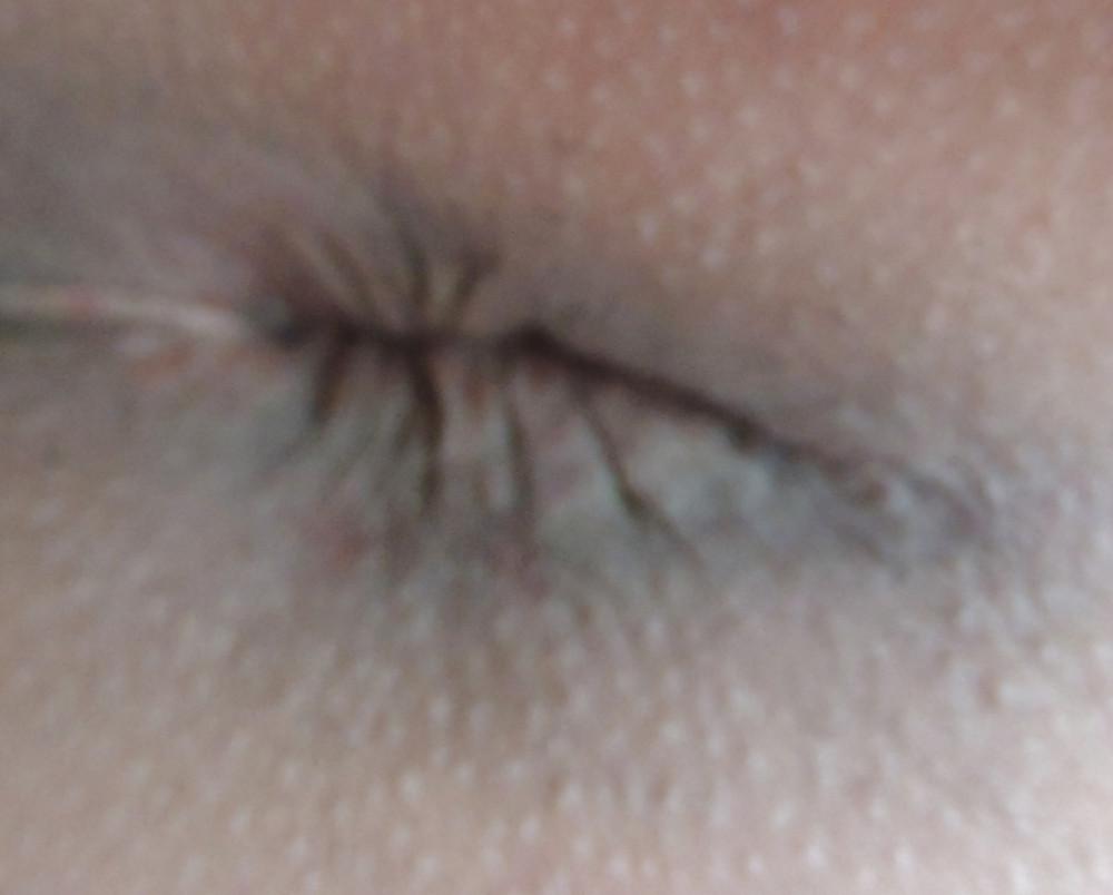 25P Amandas butthole march 2013