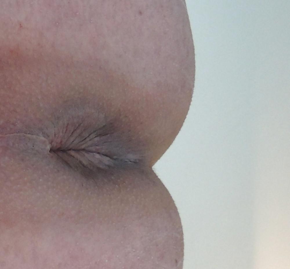 25P Amandas butthole march 2013