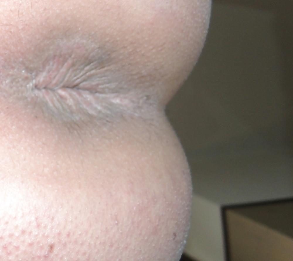 25P Amandas butthole march 2013