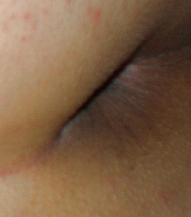 22P My nude teenage girlie butthole