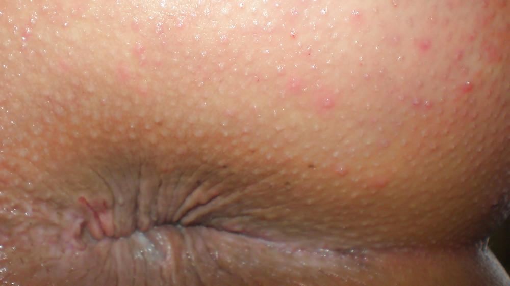 22P My nude teenage girlie butthole
