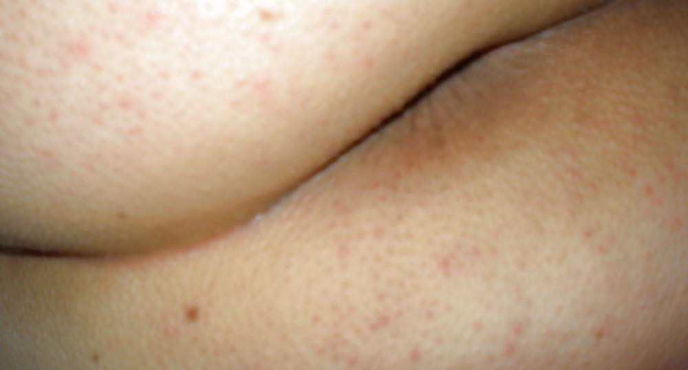 22P My nude teenage girlie butthole