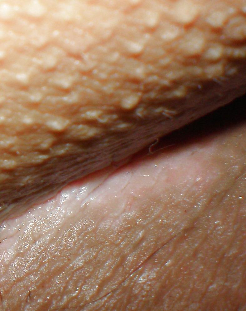 22P My nude teenage girlie butthole