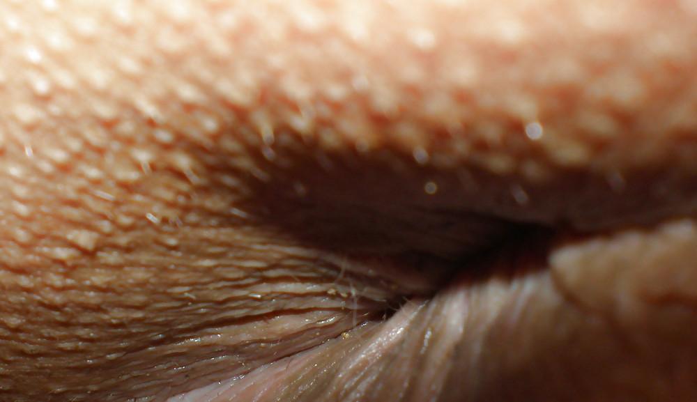 22P My nude teenage girlie butthole