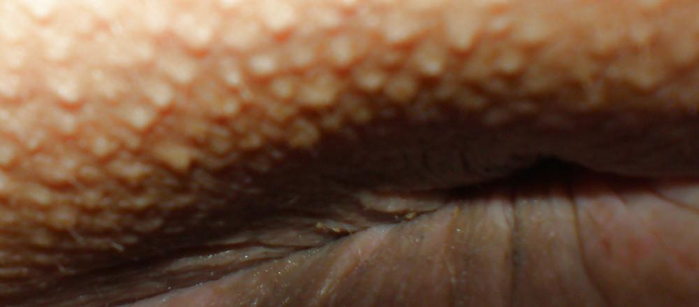22P My nude teenage girlie butthole