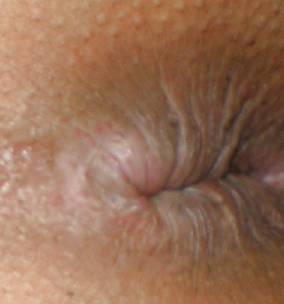 22P My nude teenage girlie butthole