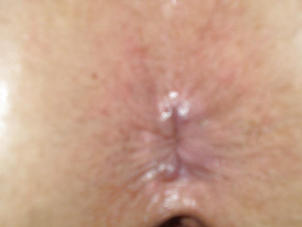 10P Thick white anal sex queen friend photos 9