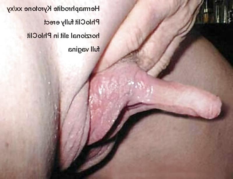 25P Hermaphrodite by shelovesit54