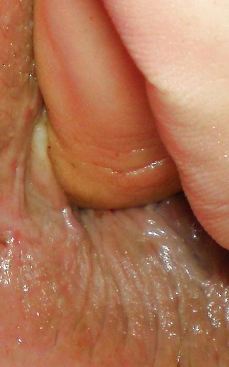 25P My girlie butthole as 18 years and 2 month old
