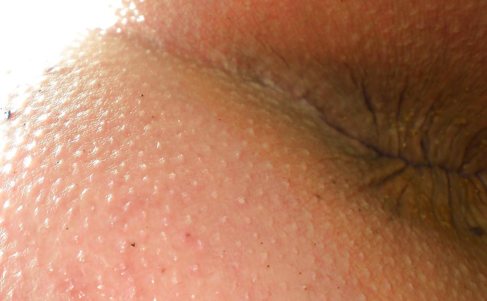25P My girlie butthole as 18 years and 2 month old