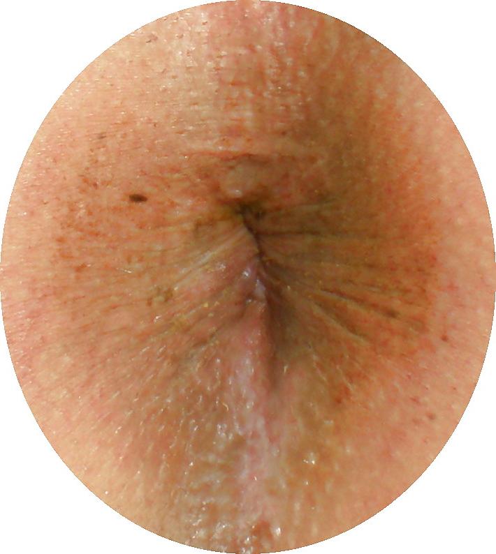25P My girlie butthole as 18 years and 2 month old