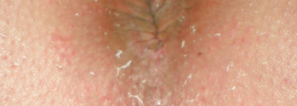 25P My girlie butthole as 18 years and 2 month old