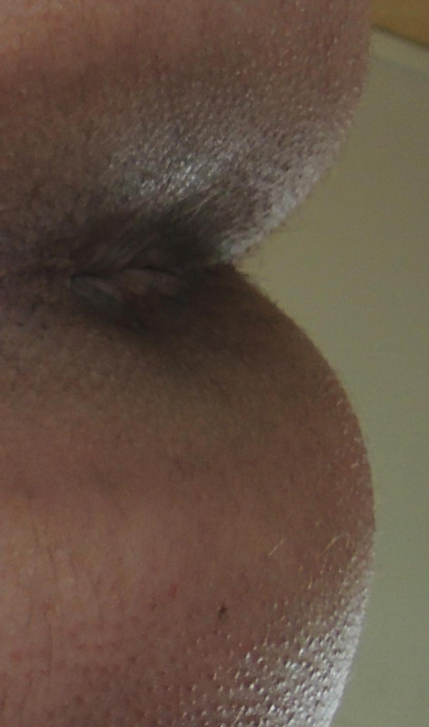 9P My butthole may 2013