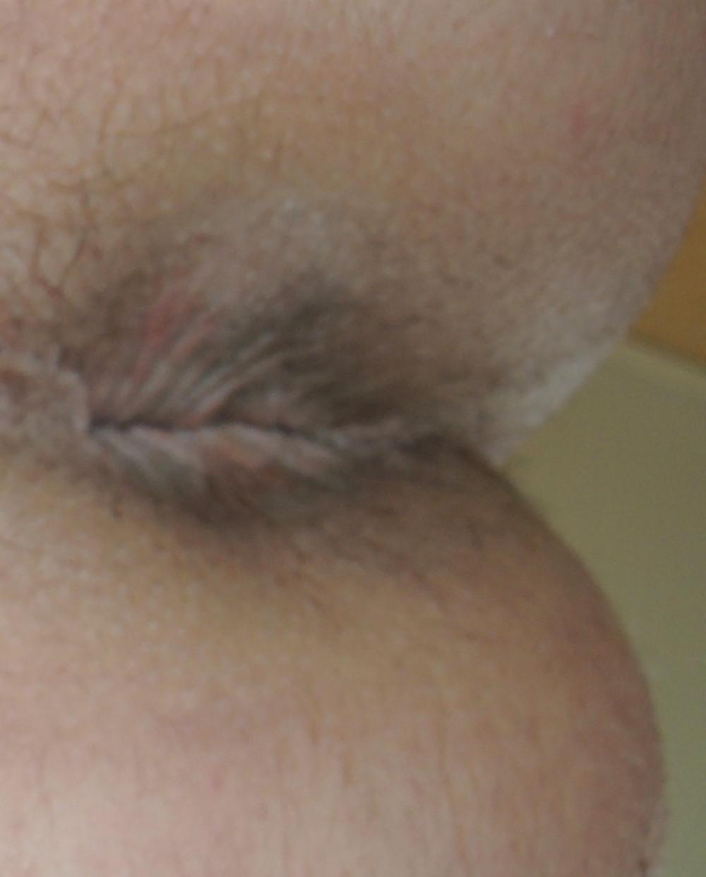 9P My butthole may 2013