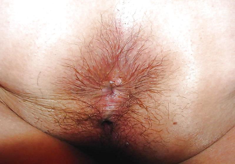 25P Hairy asshole mood? Here ya go!
