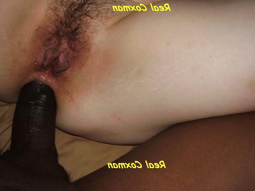 12P Rich white woman gets asshole burst open