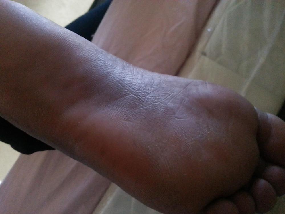25P My haitian friend and her soles