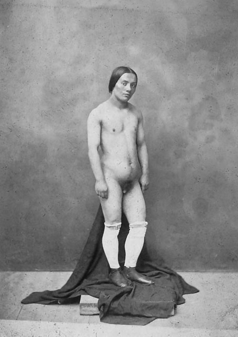 5P 1860 Hermaphrodite