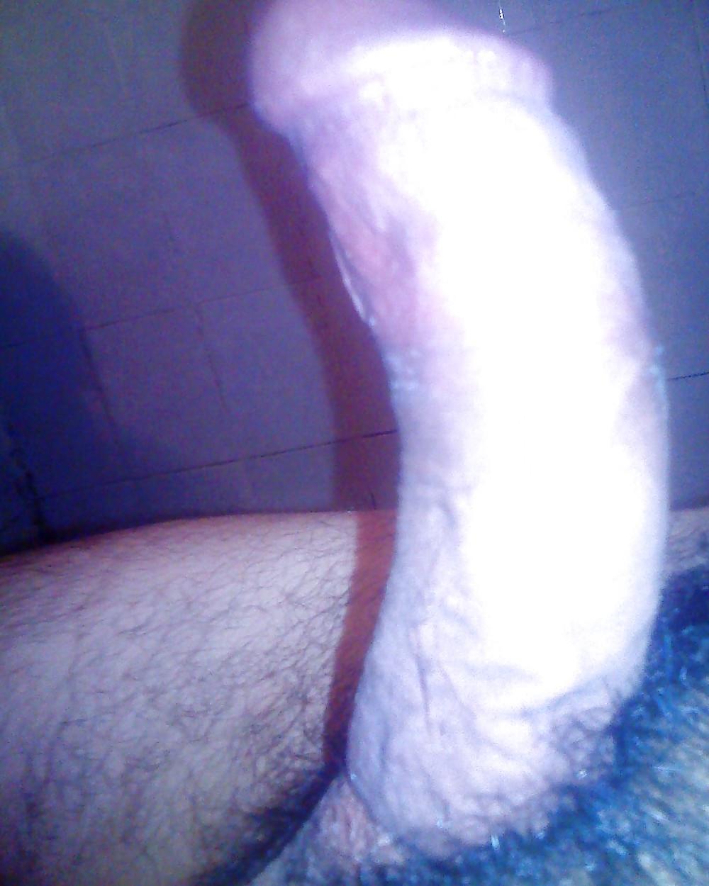 17P My penis