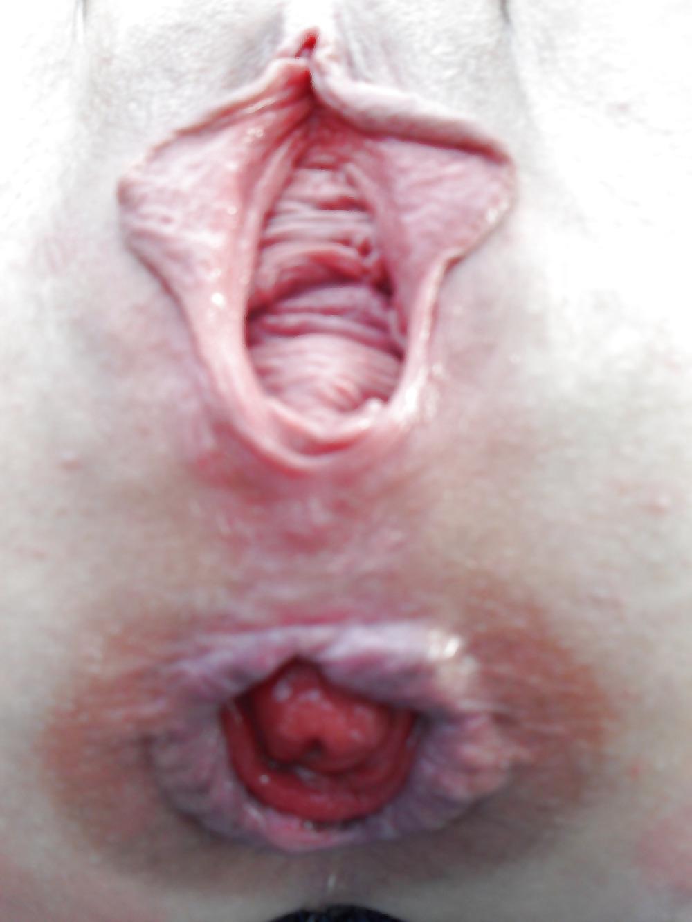 25P Asshole huge insertions!