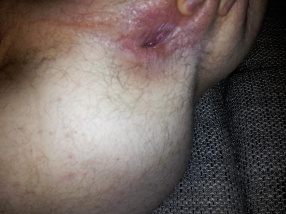 11P Asshole bit gaping